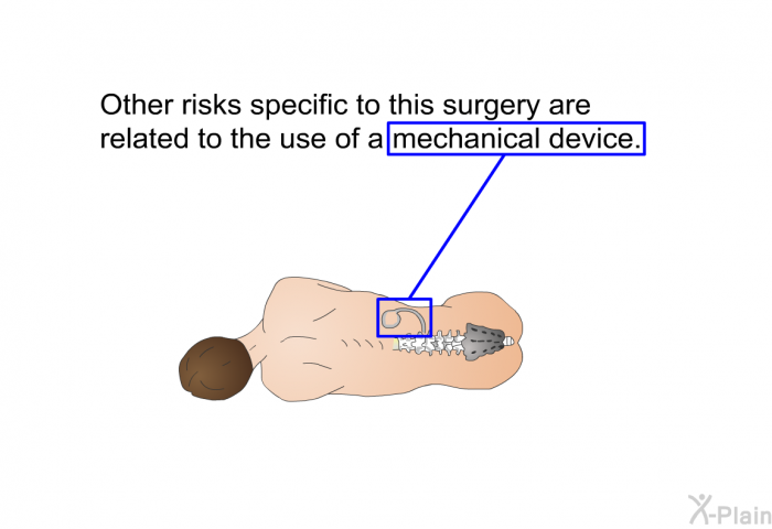 Other risks specific to this surgery are related to the use of a mechanical device.