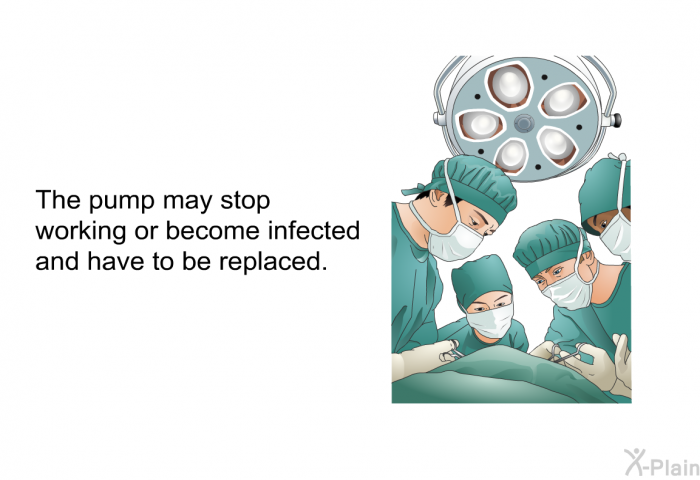 The pump may stop working or become infected and have to be replaced.