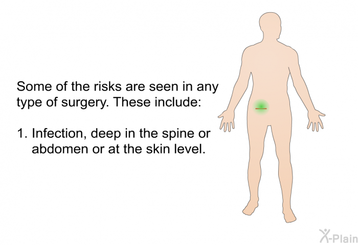 Some of the risks are seen in any type of surgery. These include:  Infection, deep in the spine or abdomen or at the skin level.