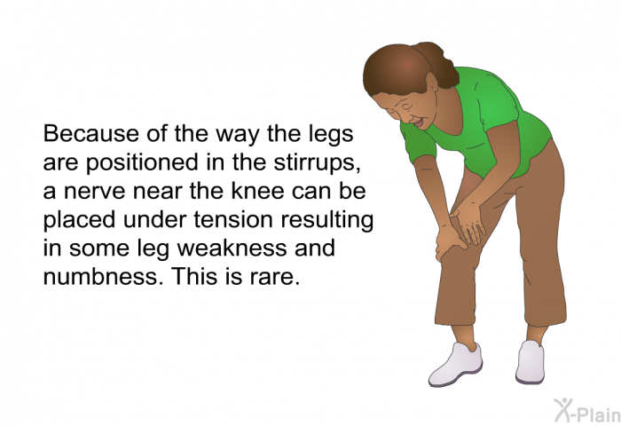 Because of the way the legs are positioned in the stirrups, a nerve near the knee can be placed under tension resulting in some leg weakness and numbness. This is rare.