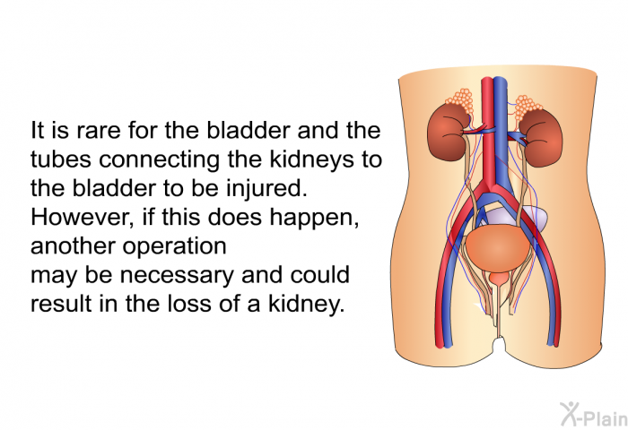 It is rare for the bladder and the tubes connecting the kidneys to the bladder to be injured. However, if this does happen, another operation may be necessary and could result in the loss of a kidney.