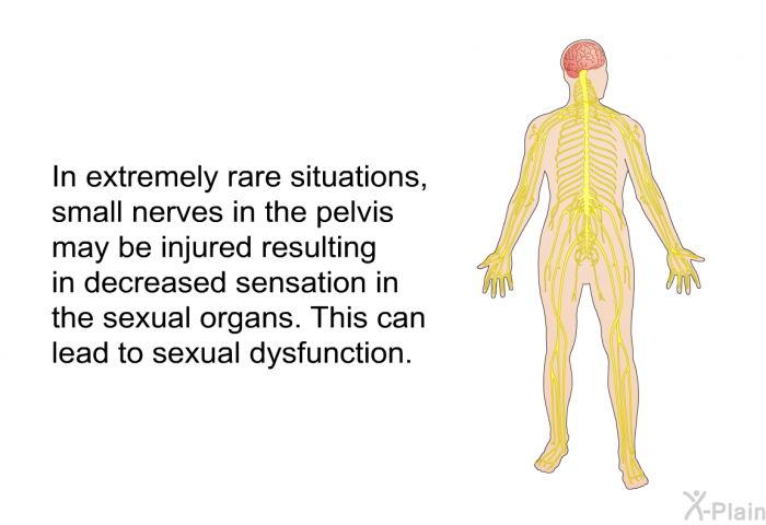In extremely rare situations, small nerves in the pelvis may be injured resulting in decreased sensation in the sexual organs. This can lead to sexual dysfunction.