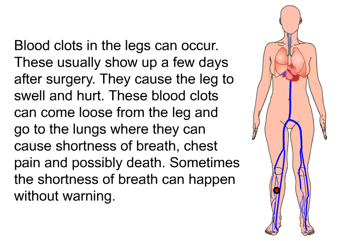 Blood clots in the legs can occur. These usually show up a few days after surgery. They cause the leg to swell and hurt. These blood clots can come loose from the leg and go to the lungs where they can cause shortness of breath, chest pain and possibly death. Sometimes the shortness of breath can happen without warning.