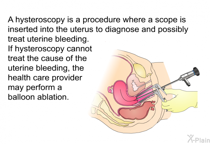 A hysteroscopy is a procedure where a scope is inserted into the uterus to diagnose and possibly treat uterine bleeding. If hysteroscopy cannot treat the cause of the uterine bleeding, the health care provider may perform a balloon ablation.
