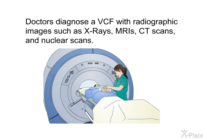 Doctors diagnose a VCF with radiographic images such as X-Rays, MRIs, CT scans, and nuclear scans.