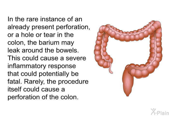 In the rare instance of an already present perforation, or a hole or tear in the colon, the barium may leak around the bowels. This could cause a severe inflammatory response that could potentially be fatal. Rarely, the procedure itself could cause a perforation of the colon.