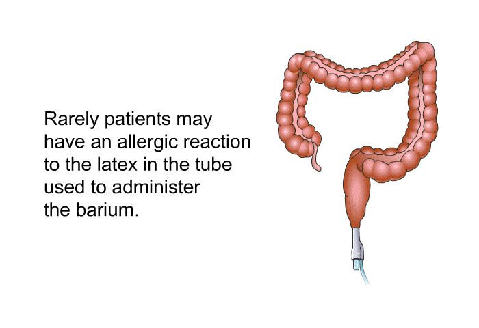 Rarely, patients may have an allergic reaction to the latex in the tube used to administer the barium.