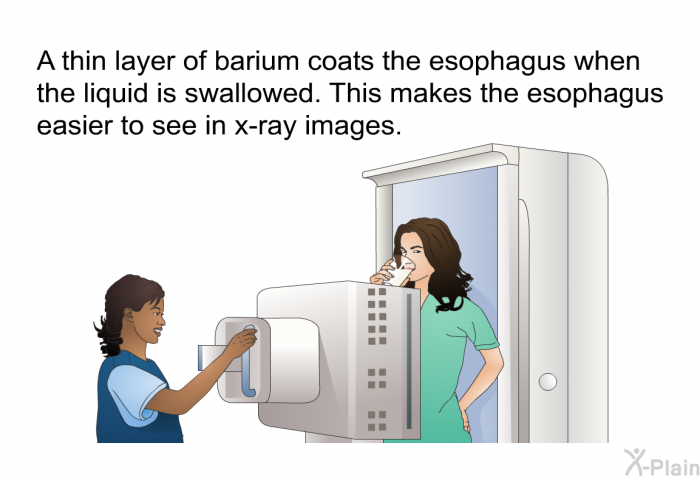A thin layer of barium coats the esophagus when the liquid is swallowed. This makes the esophagus easier to see in x-ray images.