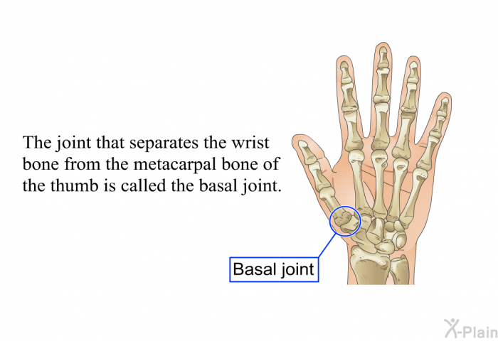 The joint that separates the wrist bone from the metacarpal bone of the thumb is called the basal joint.