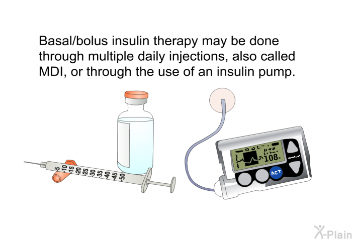Basal/bolus insulin therapy may be done through multiple daily injections, also called MDI, or through the use of an insulin pump.