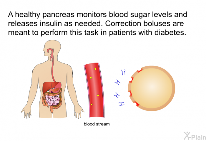 A healthy pancreas monitors blood sugar levels and releases insulin as needed. Correction boluses are meant to perform this task in patients with diabetes.