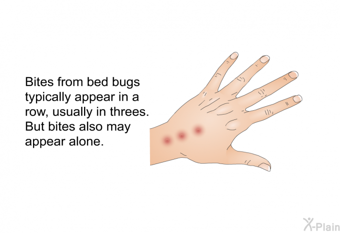 Bites from bed bugs typically appear in a row, usually in threes. But bites also may appear alone.