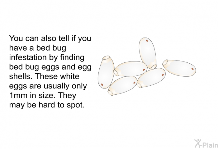 You can also tell if you have a bed bug infestation by finding bed bug eggs and egg shells. These white eggs are usually only 1mm in size. They may be hard to spot.