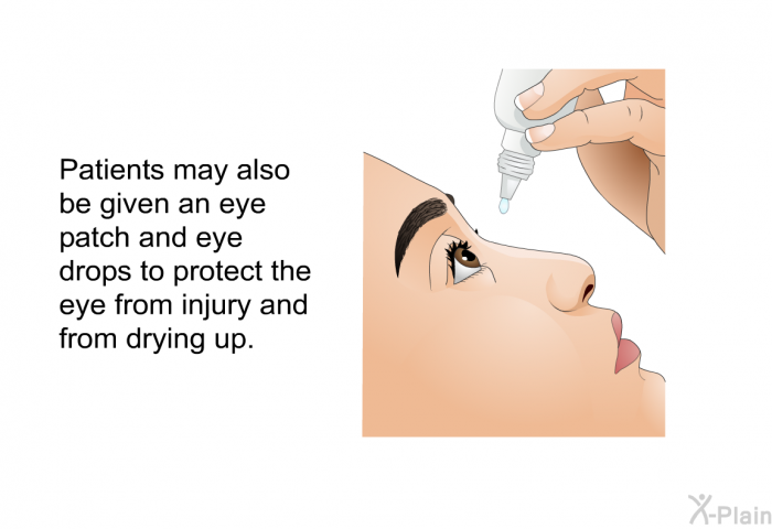 Patients may also be given an eye patch and eye drops to protect the eye from injury and from drying up.