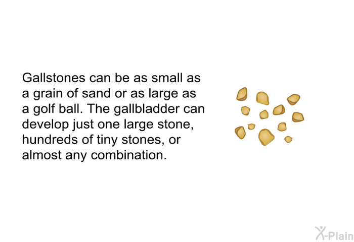 Gallstones can be as small as a grain of sand or as large as a golf ball. The gallbladder can develop just one large stone, hundreds of tiny stones, or almost any combination.