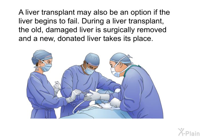 A liver transplant may also be an option if the liver begins to fail. During a liver transplant, the old, damaged liver is surgically removed and a new, donated liver takes its place.