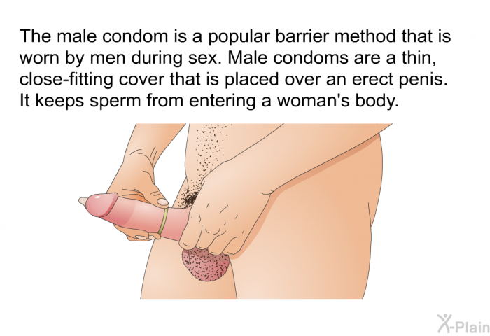 The male condom is a popular barrier method that is worn by men during sex. Male condoms are a thin, close-fitting cover that is placed over an erect penis. It keeps sperm from entering a woman's body.