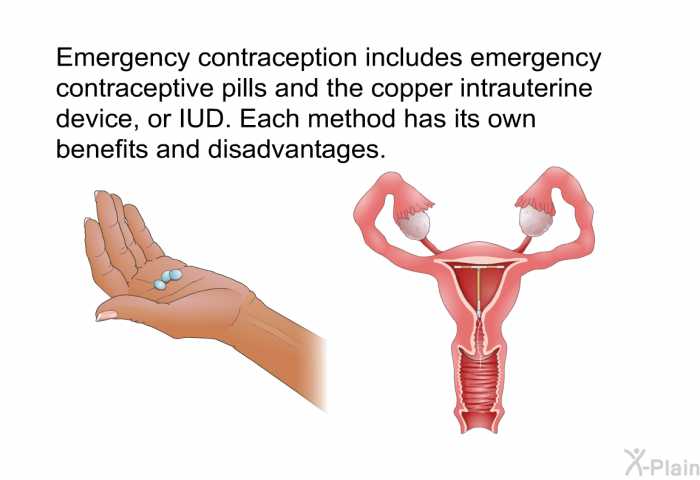 Emergency contraception includes emergency contraceptive pills and the copper intrauterine device, or IUD. Each method has its own benefits and disadvantages.