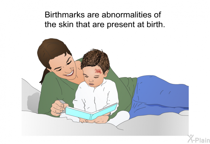 Birthmarks are abnormalities of the skin that are present at birth.
