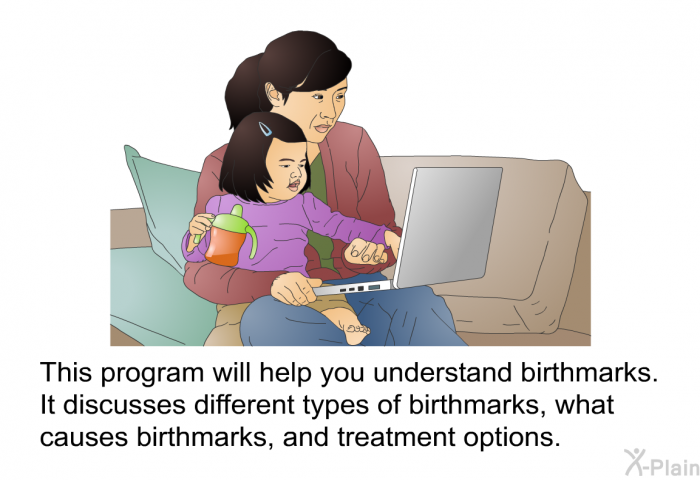 This health information will help you understand birthmarks. It discusses different types of birthmarks, what causes birthmarks, and treatment options.