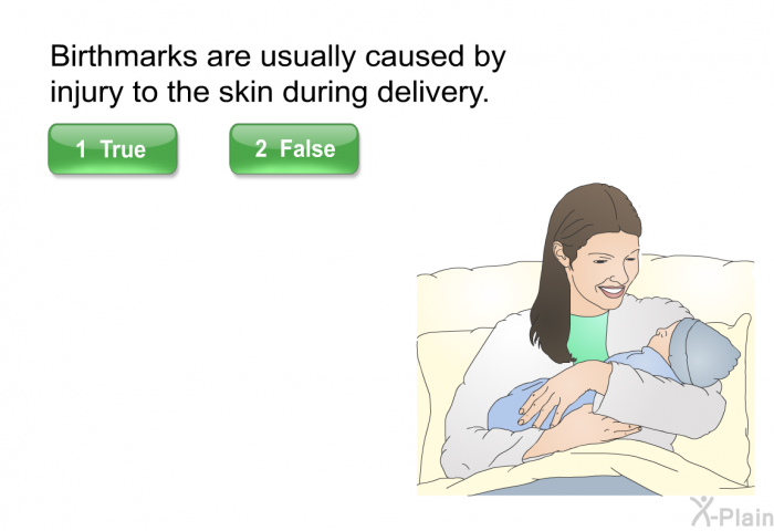 Birthmarks are usually caused by injury to the skin during delivery. Select True or False.