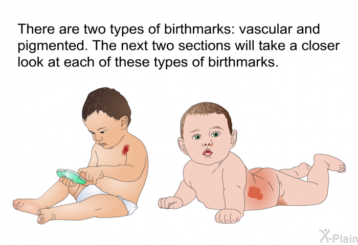 There are two types of birthmarks: vascular and pigmented. The next two sections will take a closer look at each of these types of birthmarks.