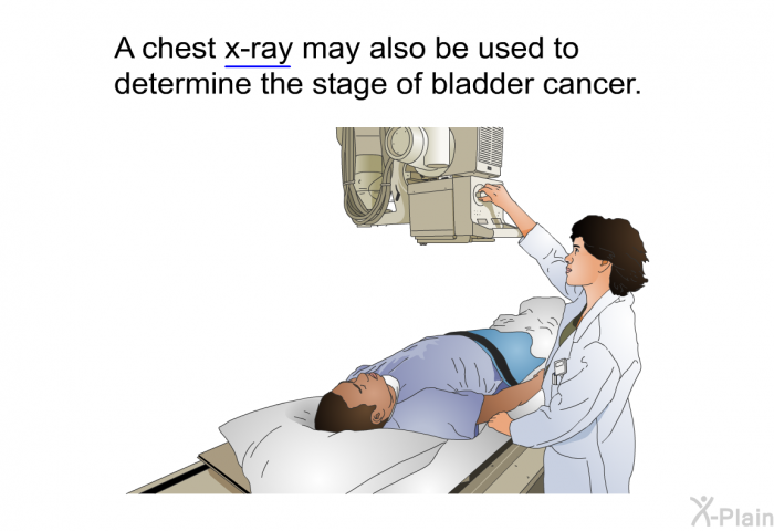 A chest x-ray may also be used to determine the stage of bladder cancer.