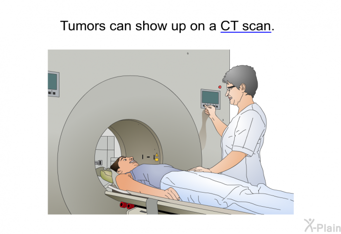 Tumors can show up on a CT scan.
