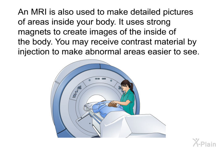 An MRI is also used to make detailed pictures of areas inside your body. It uses strong magnets to create images of the inside of the body. You may receive contrast material by injection to make abnormal areas easier to see.