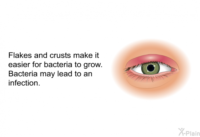 Flakes and crusts make it easier for bacteria to grow. Bacteria may lead to an infection.