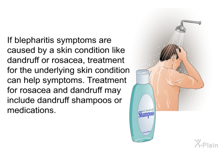 If blepharitis symptoms are caused by a skin condition like dandruff or rosacea, treatment for the underlying skin condition can help symptoms. Treatment for rosacea and dandruff may include dandruff shampoos or medications.