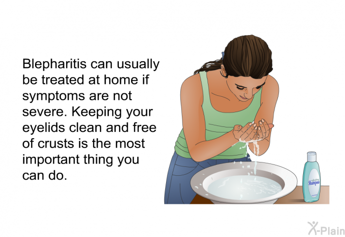 Blepharitis can usually be treated at home if symptoms are not severe. Keeping your eyelids clean and free of crusts is the most important thing you can do.