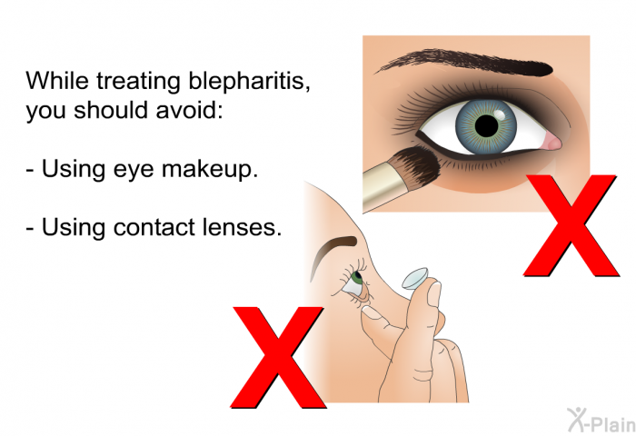 While treating blepharitis, you should avoid:  Using eye makeup. Using contact lenses.