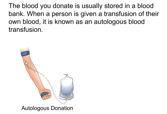 The blood you donate is usually stored in a blood bank. When a person is given a transfusion of their own blood, it is known as an autologous blood transfusion.