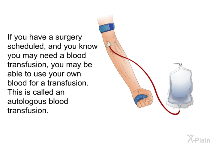 If you have a surgery scheduled, and you know you may need a blood transfusion, you may be able to use your own blood for a transfusion. This is called an autologous blood transfusion.