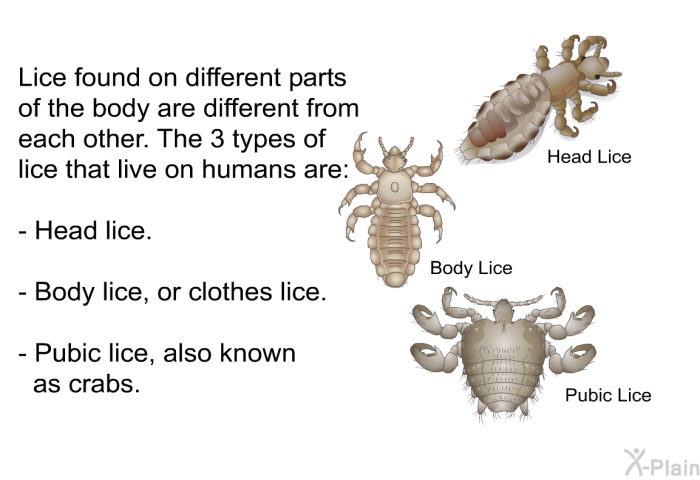 Lice found on different parts of the body are different from each other. The 3 types of lice that live on humans are:  Head lice. Body lice, or clothes lice. Pubic lice, also known as crabs.