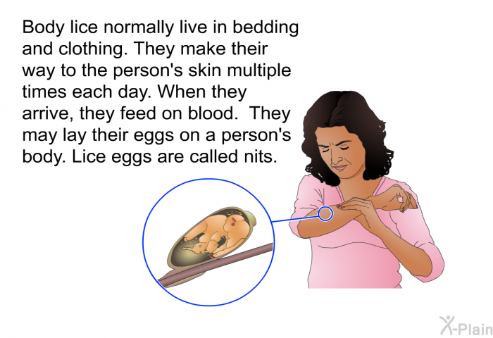 Body lice normally live in bedding and clothing. They make their way to the person's skin multiple times each day. When they arrive, they feed on blood. They may lay their eggs on a person's body. Lice eggs are called nits.