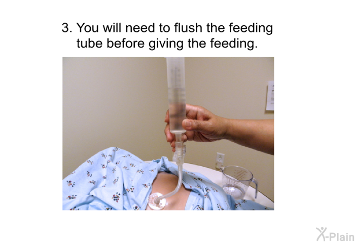 You will need to flush the feeding tube before giving the feeding.