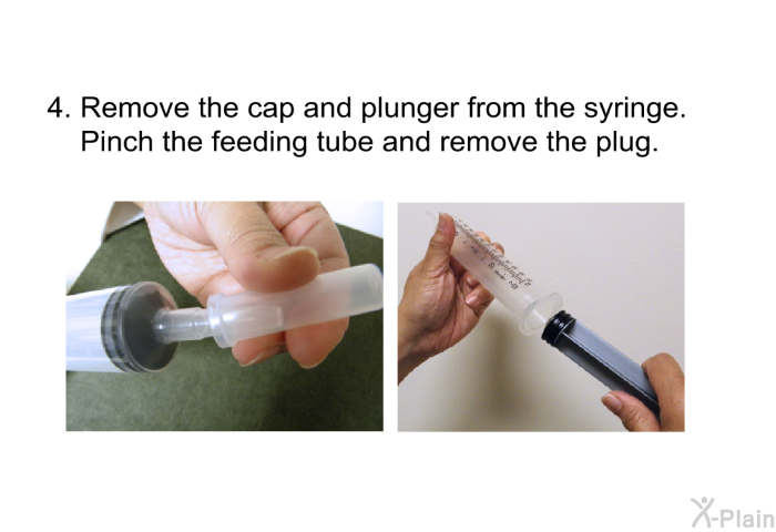 Remove the cap and plunger from the syringe. Pinch the feeding tube and remove the plug.