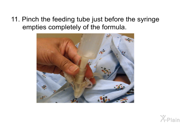 Pinch the feeding tube just before the syringe empties completely of the formula.