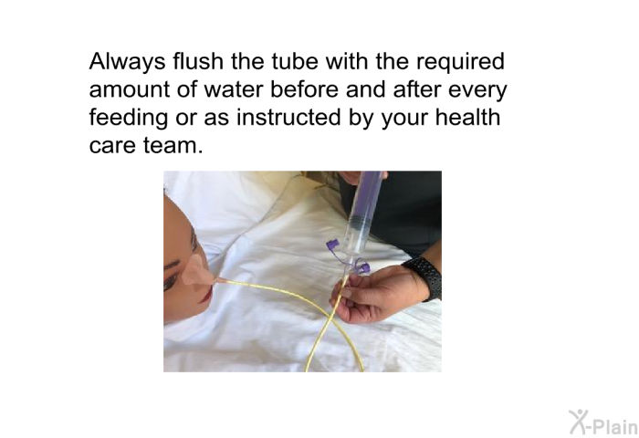 Always flush the tube with the required amount of water before and after every feeding or as instructed by your health care team.