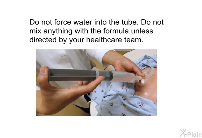 Do not force water into the tube. Do not mix anything with the formula unless directed by your health care team.