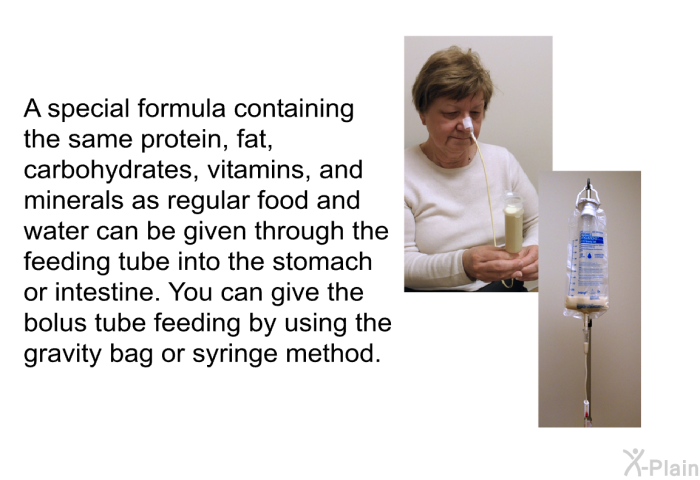 A special formula containing the same protein, fat, carbohydrates, vitamins, and minerals as regular food and water can be given through the feeding tube into the stomach or intestine. You can give the bolus tube feeding by using the gravity bag or syringe method.