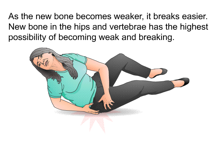 As the new bone becomes weaker, it breaks easier. New bone in the hips and vertebrae has the highest possibility of becoming weak and breaking.