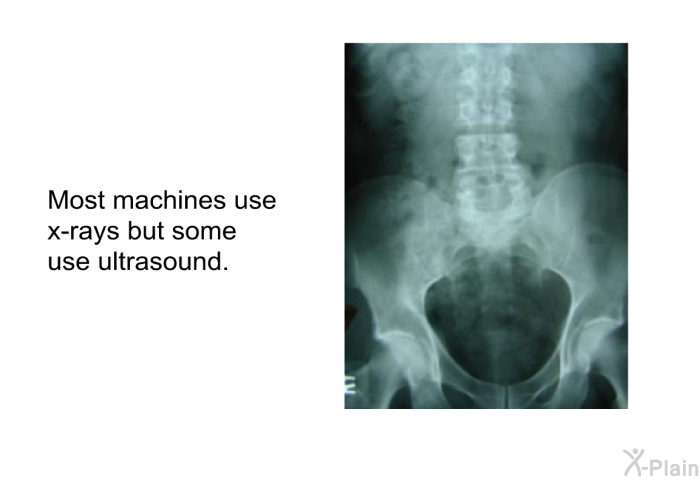 Most machines use x-rays but some use ultrasound.