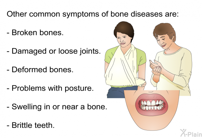 Other common symptoms of bone diseases are:  Broken bones. Damaged or loose joints. Deformed bones. Problems with posture. Swelling in or near a bone. Brittle teeth.