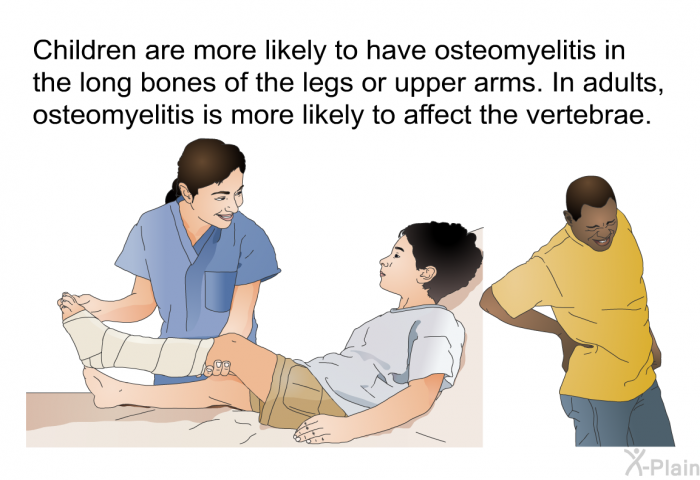 Children are more likely to have osteomyelitis in the long bones of the legs or upper arms. In adults, osteomyelitis is more likely to affect the vertebrae.