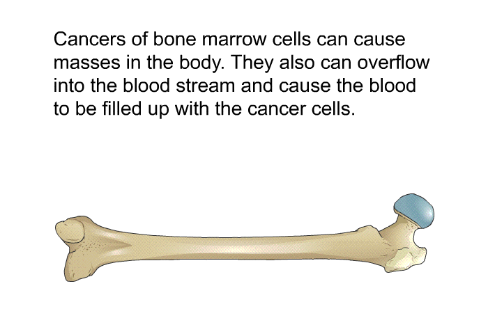 Cancers of bone marrow cells can cause masses in the body. They also can overflow into the blood stream and cause the blood to be filled up with the cancer cells.