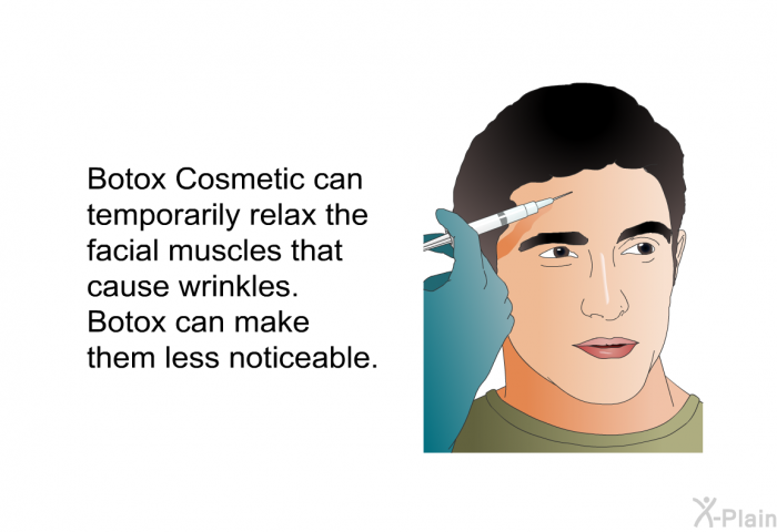 Botox Cosmetic can temporarily relax the facial muscles that cause wrinkles. Botox can make them less noticeable.