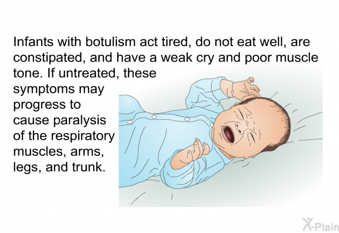 Infants with botulism act tired, do not eat well, are constipated, and have a weak cry and poor muscle tone. If untreated, these symptoms may progress to cause paralysis of the respiratory muscles, arms, legs, and trunk.